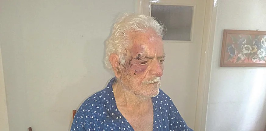 Πάτρα – Απόπειρα ληστείας: Σοκάρουν τα σημάδια σε 90χρονο – Καθηλωμένη η συζύγός του